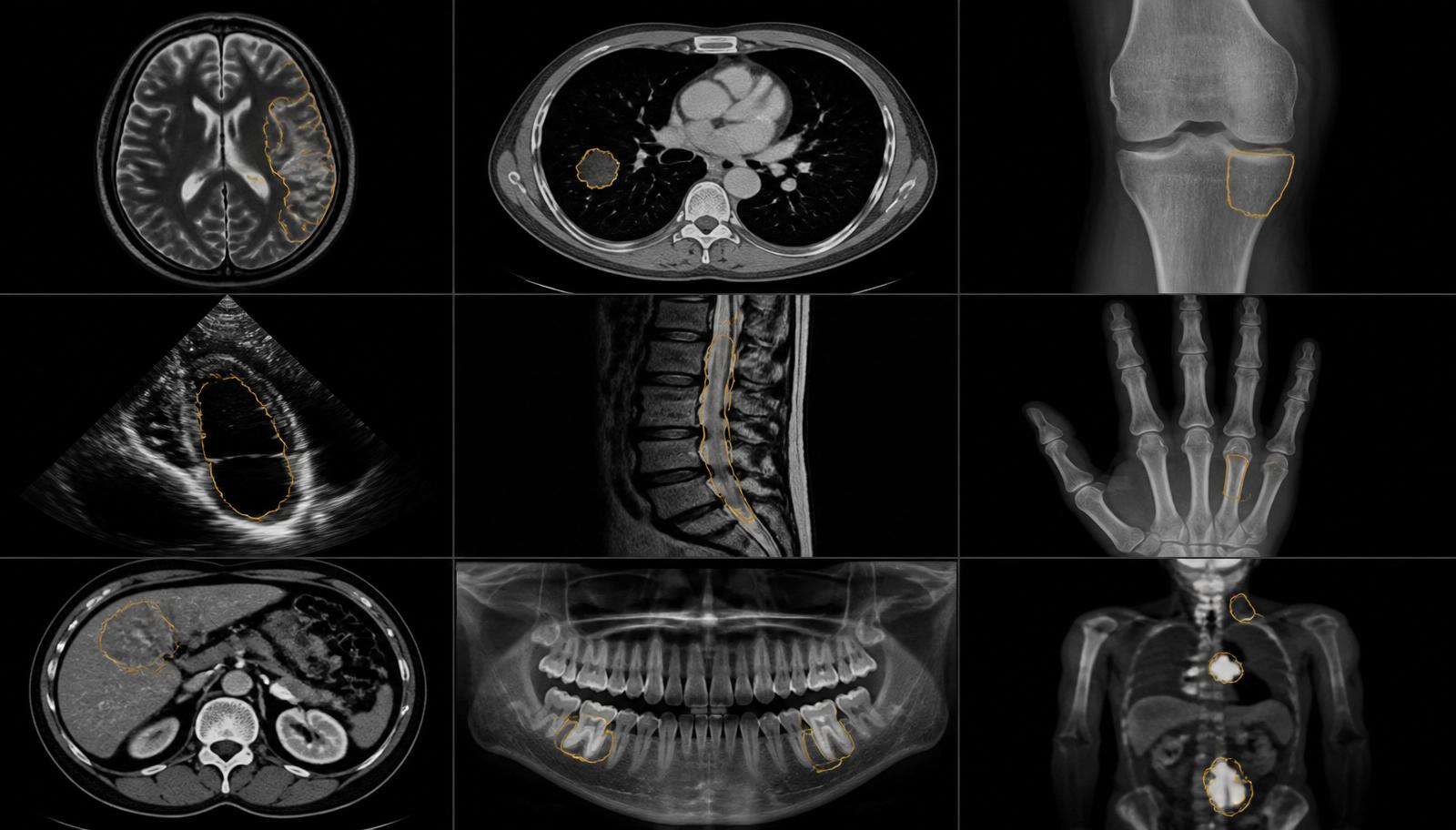 Grid of medical imaging modalities annotated by Amplitude Healthcare: brain MRI, chest CT, X-ray, ultrasound, spine MRI, dental CBCT, PET